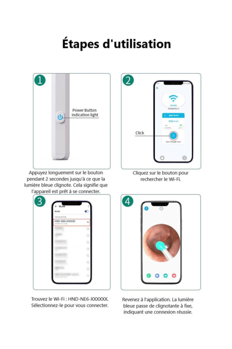 Otoscope de nettoyage d'oreille 1080P HD WiFi Platyne