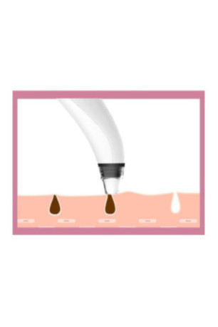 Aspirateur points noirs avec caméra intégrée