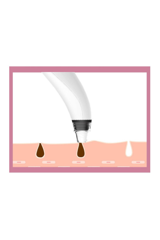 Aspirateur points noirs avec caméra intégrée